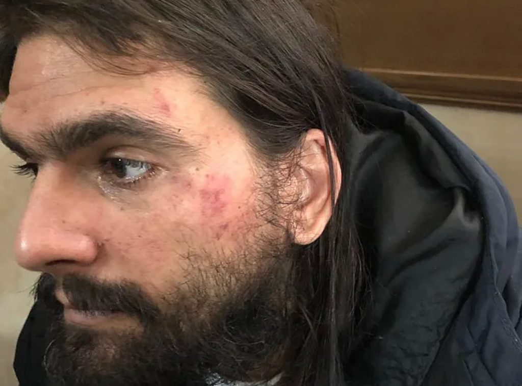 אשתו של מייסד טלגראס: "פיצצו אותו במכות, הוא מלא בדם"