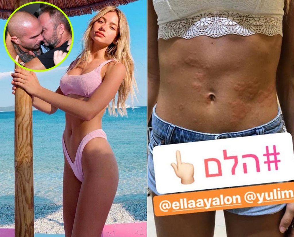 מה קרה להם על האי? שורדי ושורדות VIP שחזרו במצב שלא בטוח תזהו!