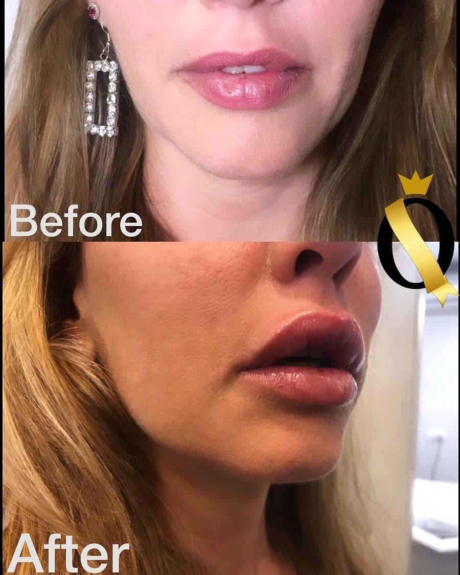 אודליה סויסה וחגית היימן עשו שינוי מפתיע בלוק!