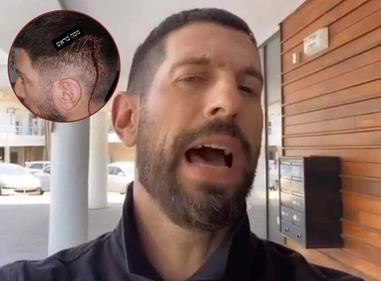 אחרי שנפגע במהלך הצילומים: חיים אתגר חושף את התוקף!