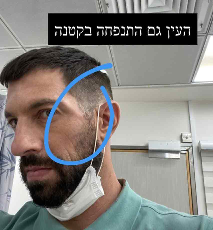 אחרי שנפגע במהלך הצילומים: חיים אתגר חושף את התוקף!