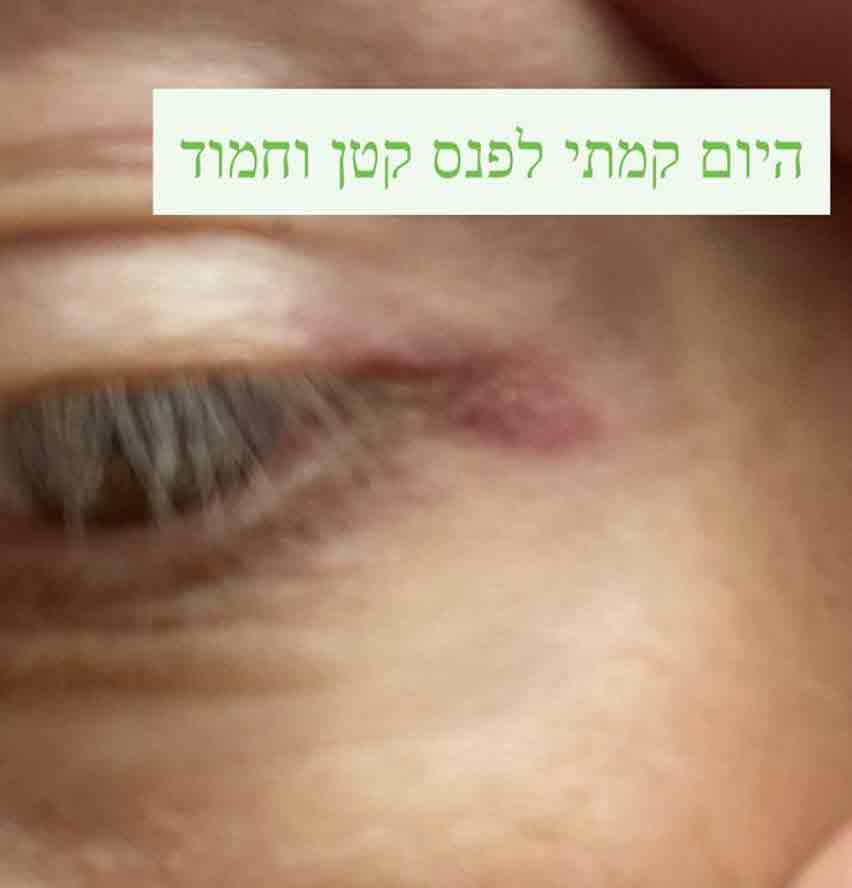 אחרי שנפגע במהלך הצילומים: חיים אתגר חושף את התוקף!