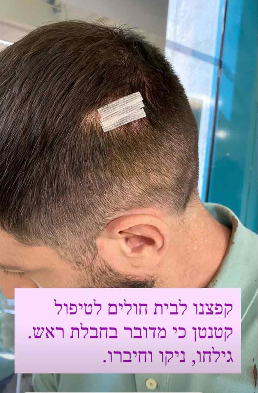אחרי שנפגע במהלך הצילומים: חיים אתגר חושף את התוקף!