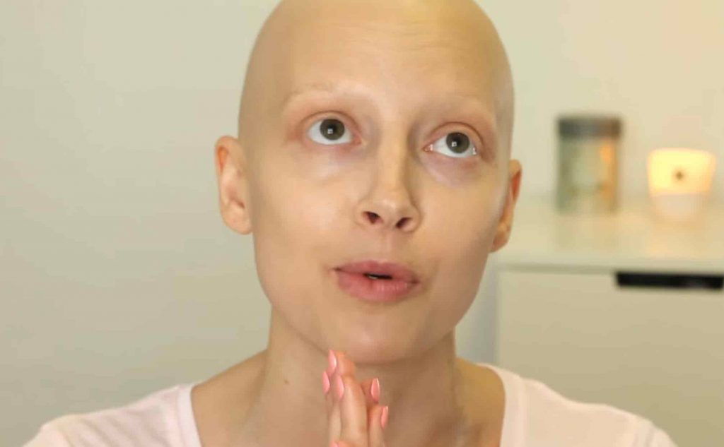 כוכבת "האח הגדול" בפנייה נרגשת:"תנו לי הזדמנות נוספת לחיים"