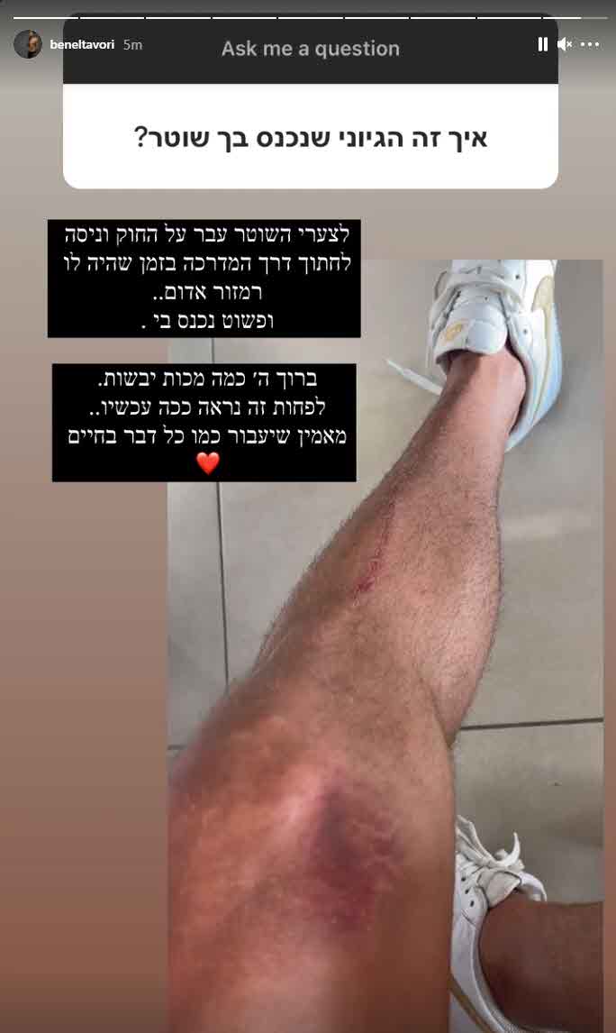בן אל תבורי מגיב לתאונת האופנוע עם השוטר:"השוטר עבר על החוק ונכנס בי"