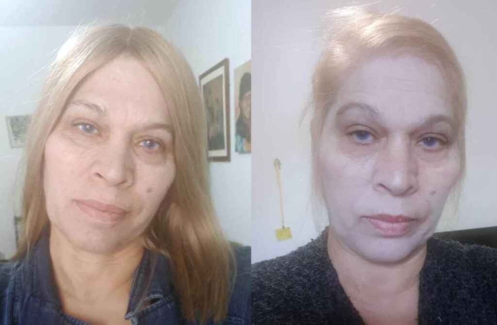 בצעד מפתיע: יהודית באומן החליטה לחשוף "מעדיפה ללכת ללא שער כדי להשיג כל שקל לבתי"