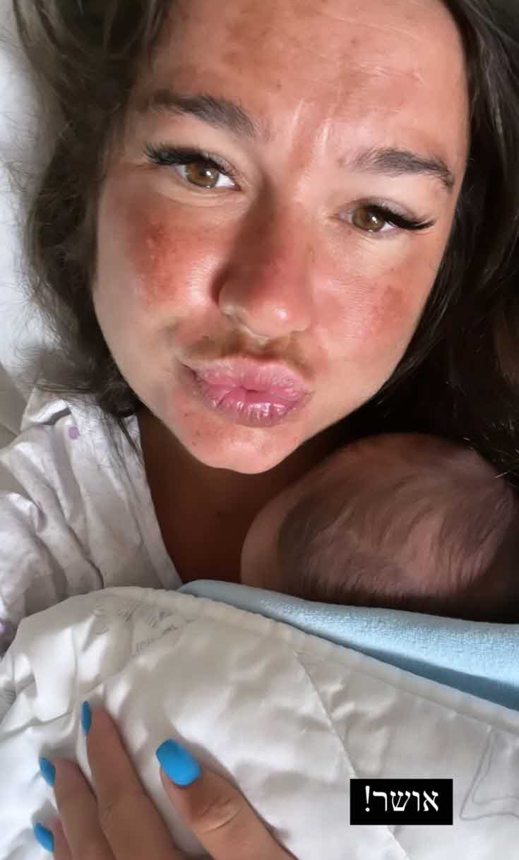 רגעי האימה בלידה של אדל בספלוב נחשפים:"הוא יצא בלי דופק בלי נשימה"