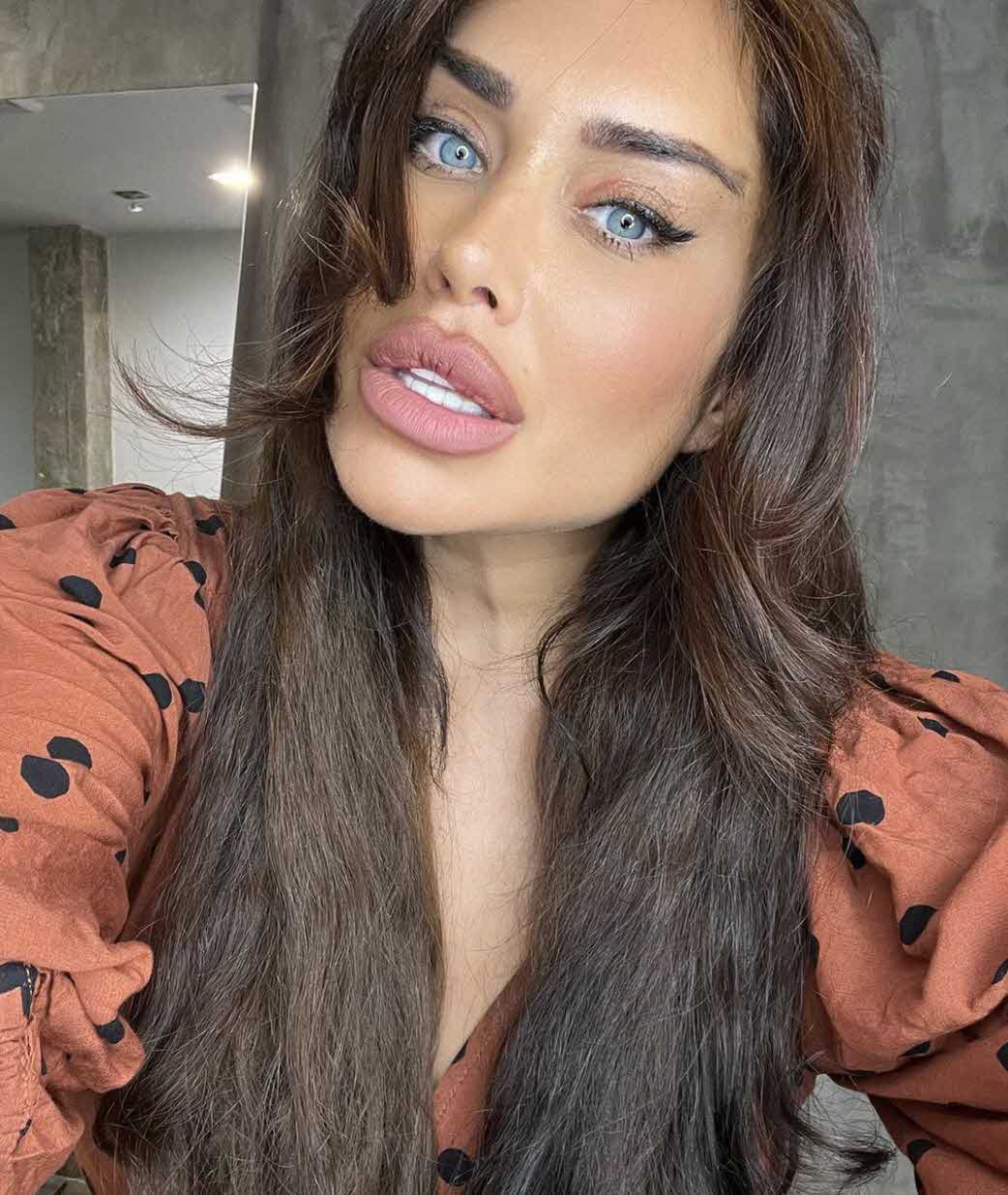 הלם: בקושי הצלחנו לזהות שזאת אביבית בר זוהר אחרי תוצאות הניתוח!