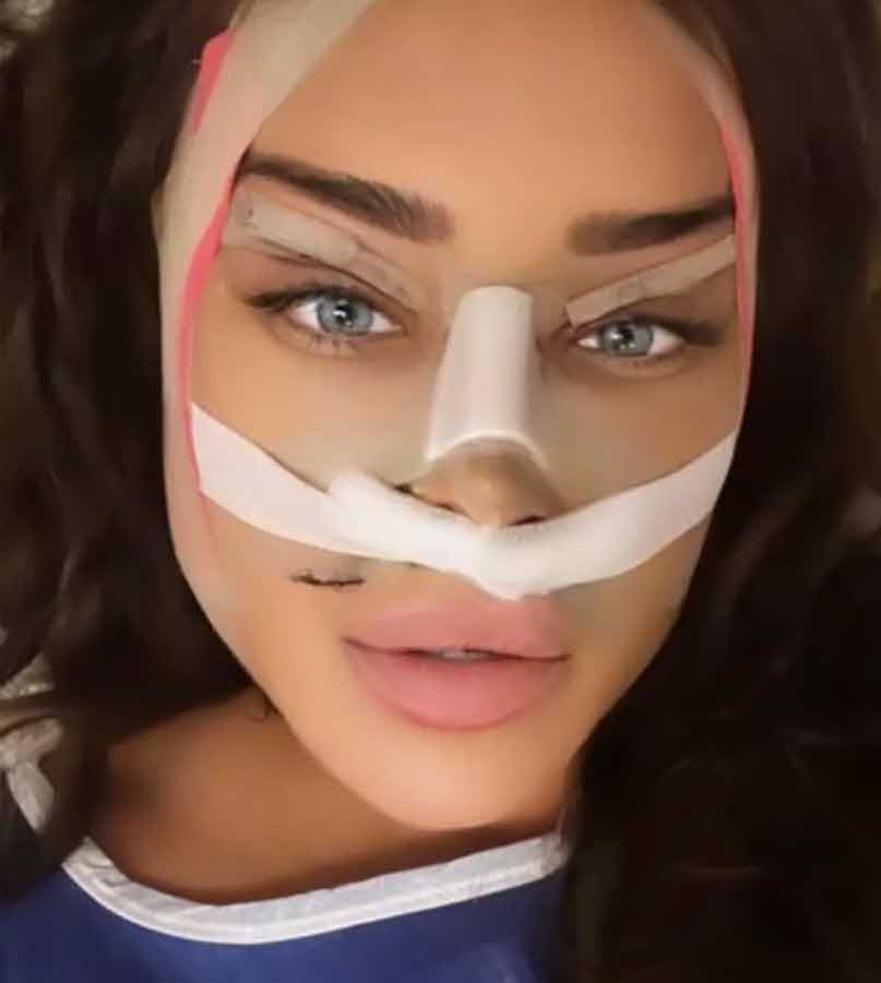 הלם: בקושי הצלחנו לזהות שזאת אביבית בר זוהר אחרי תוצאות הניתוח!