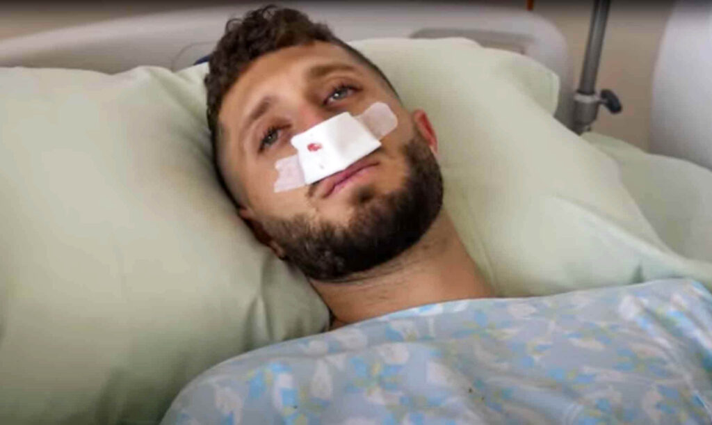 בן זיני עבר ניתוח אף בהרדמה מלאה וחשף את התוצאה!