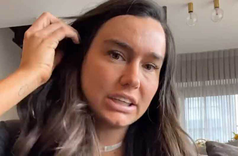 בלי פילטרים: אדל בספלוב חושפת את הצלקת שנותרה מהניתוח בצוואר