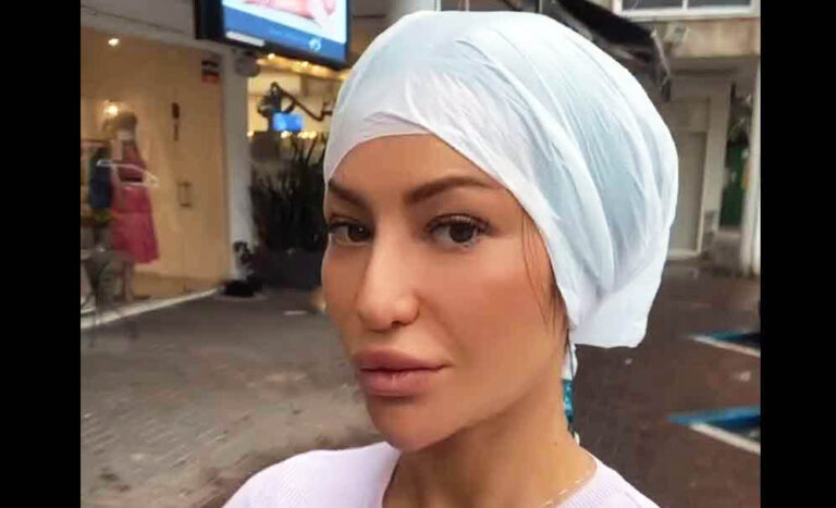 מתחזקת? זוכת הישרדות אלה אייבנדר העלתה תיעוד שגרם לבלבול