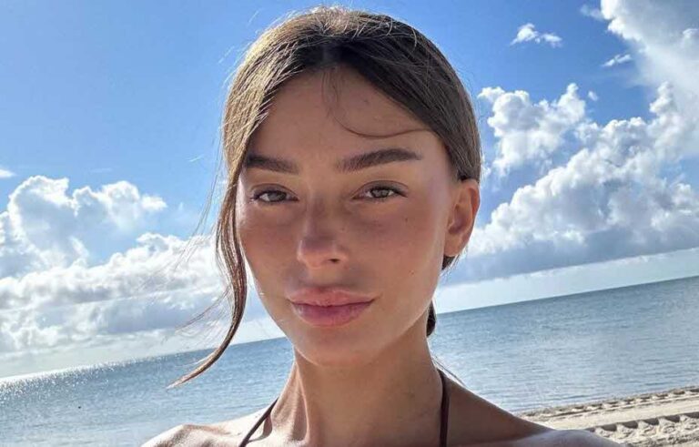 דיאן שוורץ המומה: ההפרעה הנפשית שממנה היא סובלת נחשפת