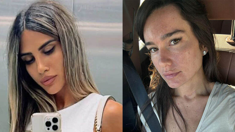 פאני בוזגלו יוצאת לצד אדל בספלוב: "דיי עם היפי נפש האלה, תקראו לזה גזענות"