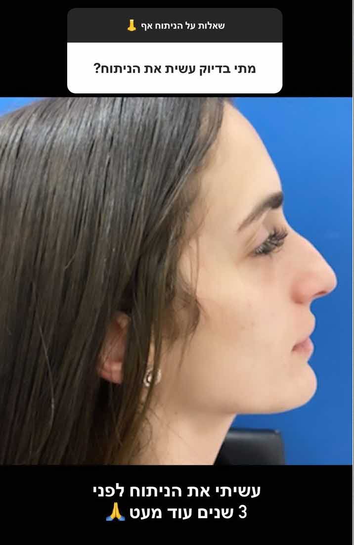 תזהו אותה? לא תאמינו איך נראתה פעם יובל מעתוק