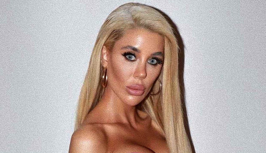 לא הספיק לה: סתיו קצין בדרך לניתוח פלסטי נוסף?