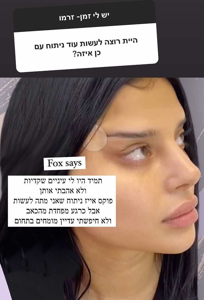 לא הספיק לה: סתיו קצין בדרך לניתוח פלסטי נוסף?