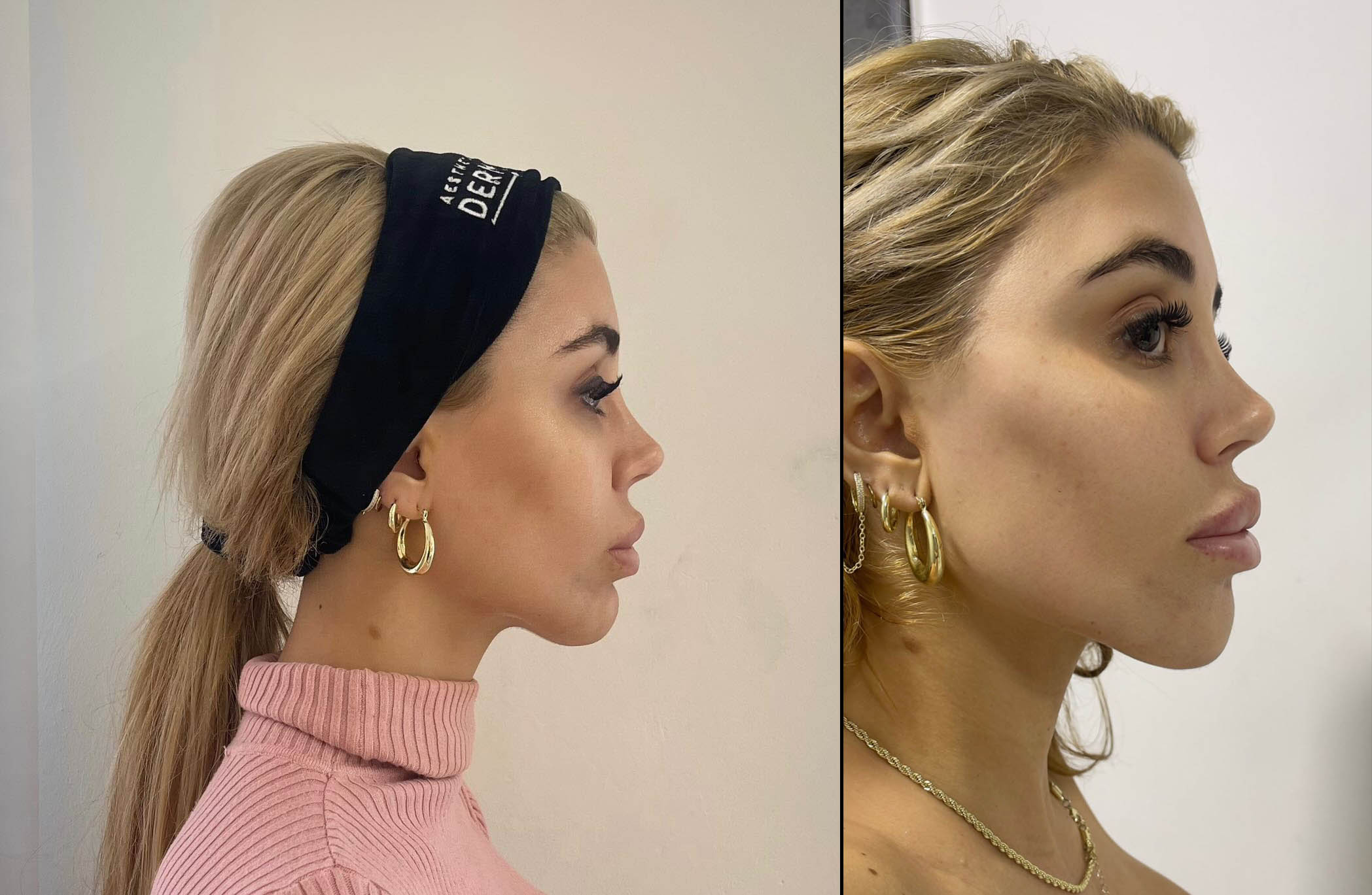 ברבי ללא מעצורים: לשינוי הבא של סתיו קצין לא היינו מוכנים