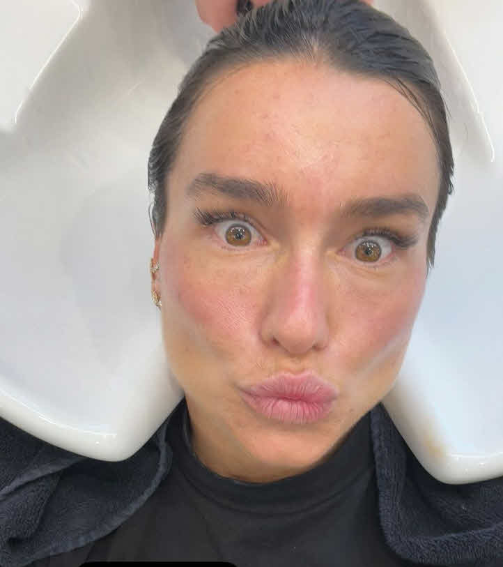 "הסרטן עף לי מהגוף ולא יחזור יותר": אדל בספלוב חושפת באומץ