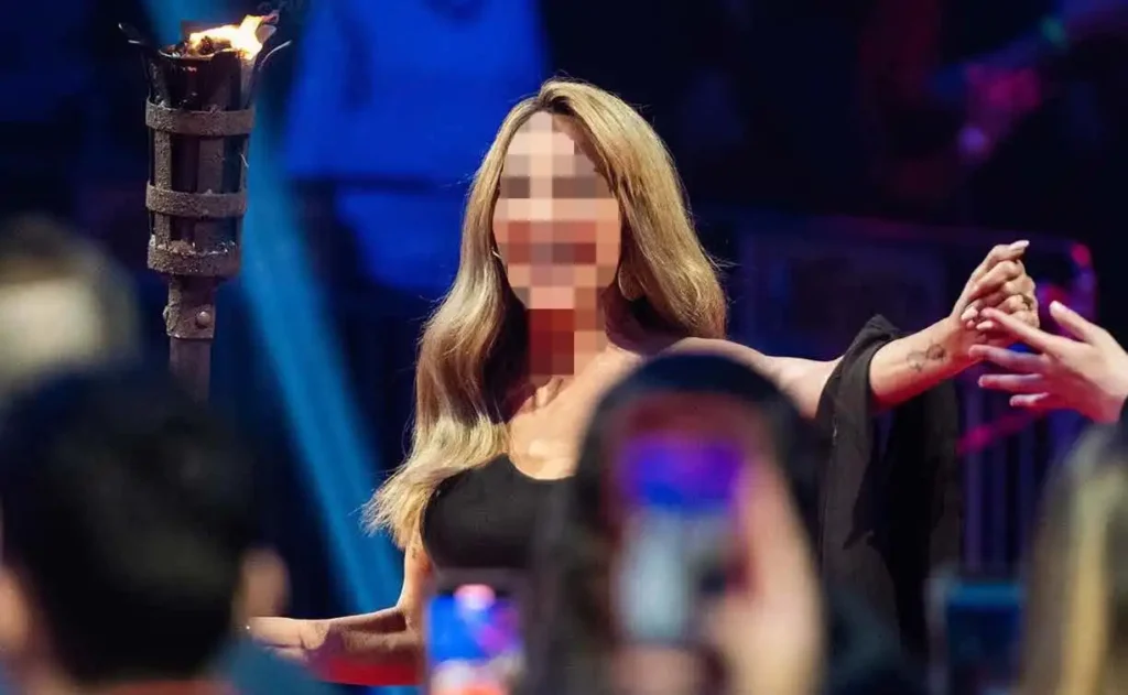 אוי לא: כוכבת הישרדות עברה תאונה וסובלת מזעזוע מח