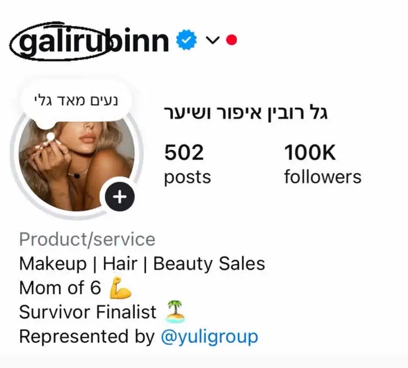 גל רובין בשינוי דרמטי בחייה ולא תאמינו מה הסיבה