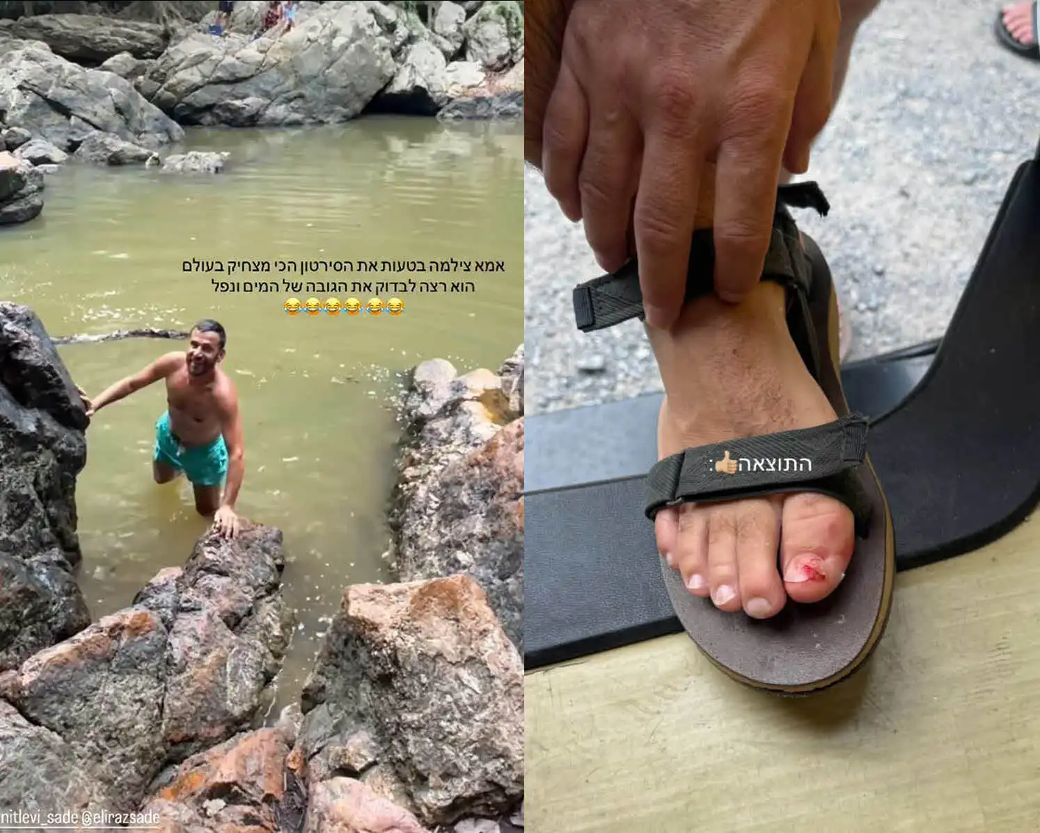 "ירד לי הלב": אלירז שדה נפצע במהלך הטיול המשפחתי