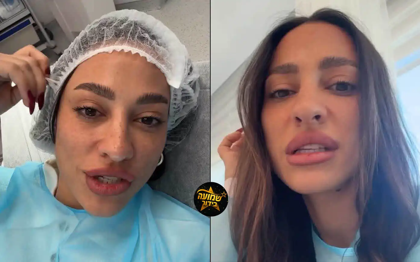 שני אדרי עברה הליך רפואי: "לא מוכנה לזה נפשית"