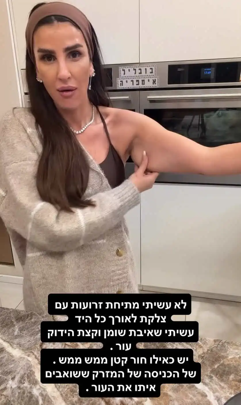 עינב בובליל עברה ניתוח בהרדמה מלאה: "ניסיתי להסתיר את זה"