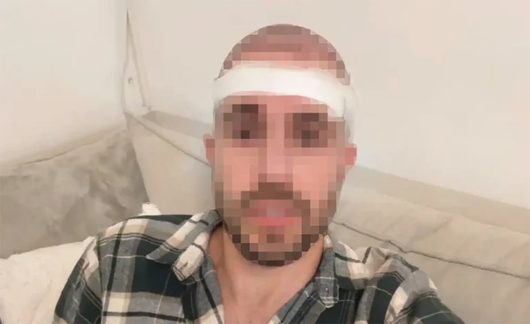 "למה עשית את זה?": יוצא האח הגדול עבר ניתוח מפתיע