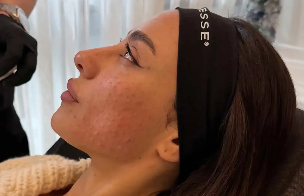 שני אדרי לא מסתירה: זה ההליך שעברה והתגובות לא איחרו להגיע