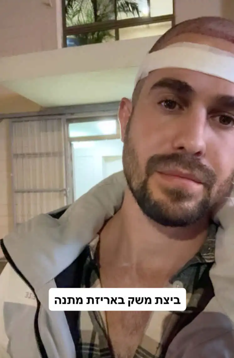 "למה עשית את זה?": יוצא האח הגדול עבר ניתוח מפתיע