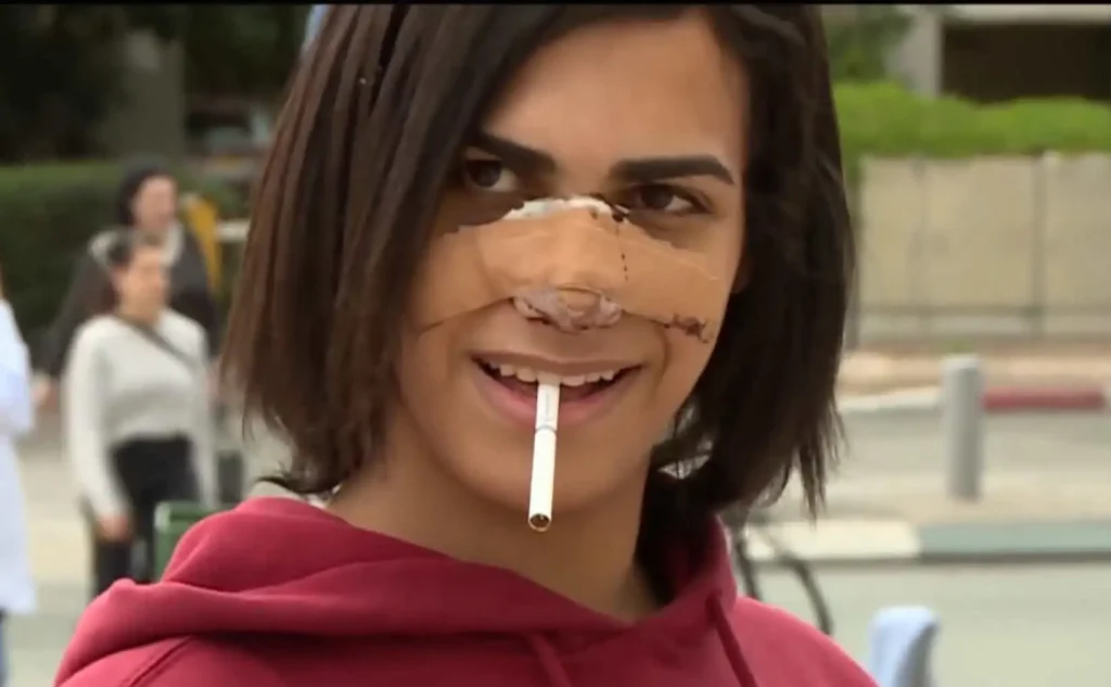 נחשף הלינץ' שממנו כמעט ולא יצאה בחיים מירה נואף