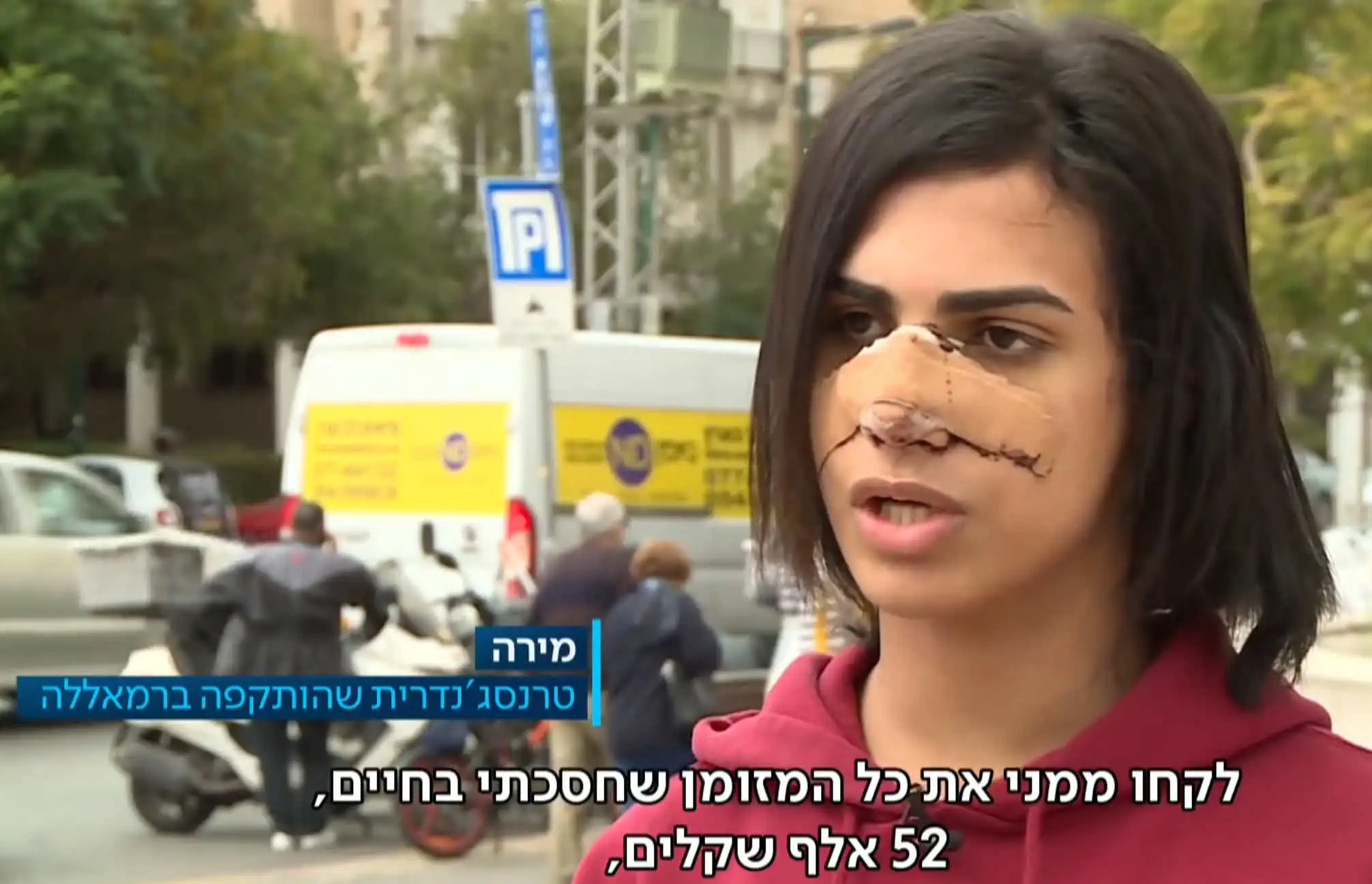 נחשף הלינץ' שממנו כמעט ולא יצאה בחיים מירה נואף