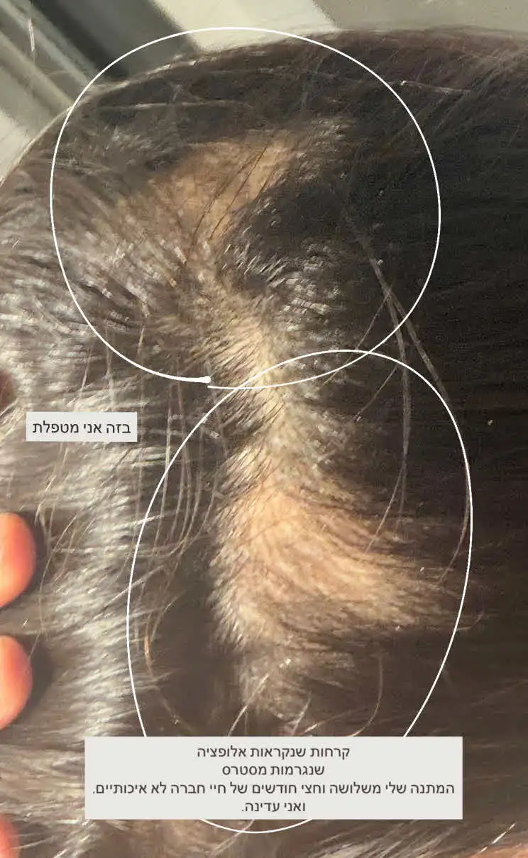 לגל רובין נפל האסימון סופית: "המומה ומאוכזבת, לראות ולא להאמין"