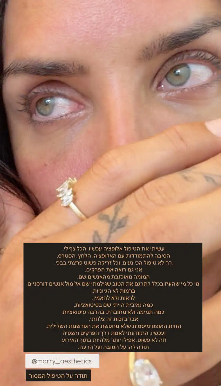 לגל רובין נפל האסימון סופית: "המומה ומאוכזבת, לראות ולא להאמין"